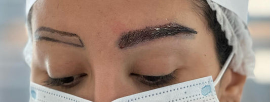 زراعة الحواجب